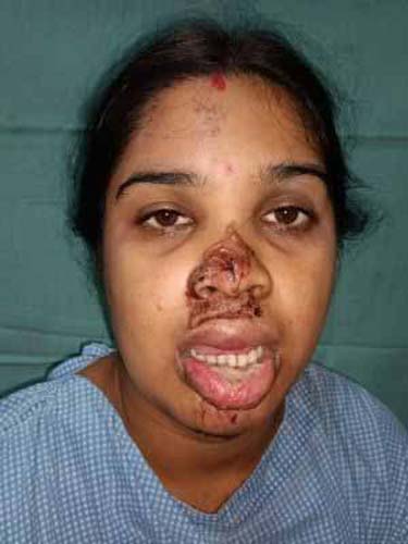 Before treatment case by Sunandini Padhy