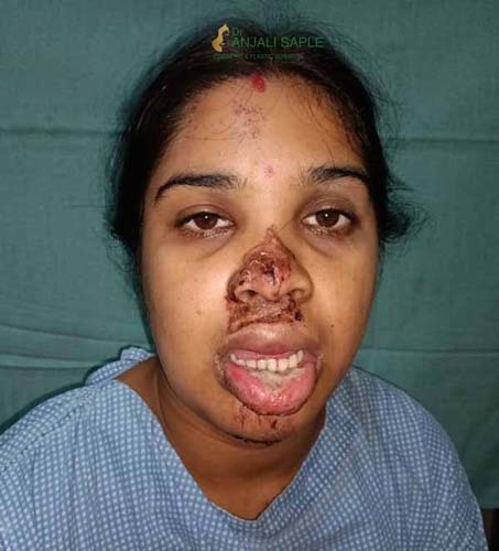 Sunandini Padhy Before Treatment