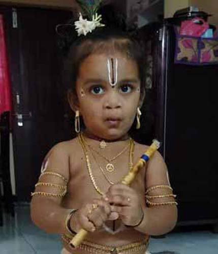 Cleft lip patient story after surgery