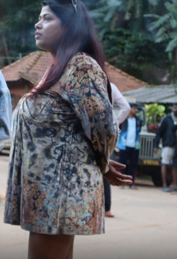 Nishtha before breast reduction - side profile in floral printed tunic showing posture, outdoors